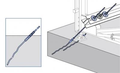 Anchoring with pigtail anchors